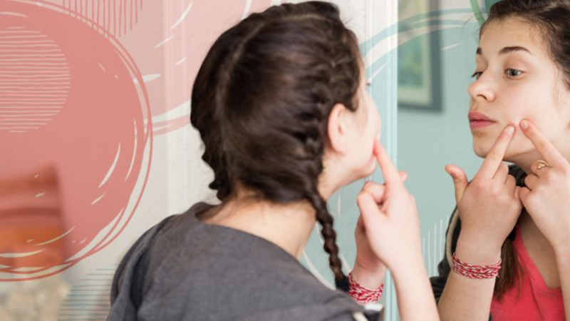 4 Perfect beauty hack for zits-susceptible pores and skin