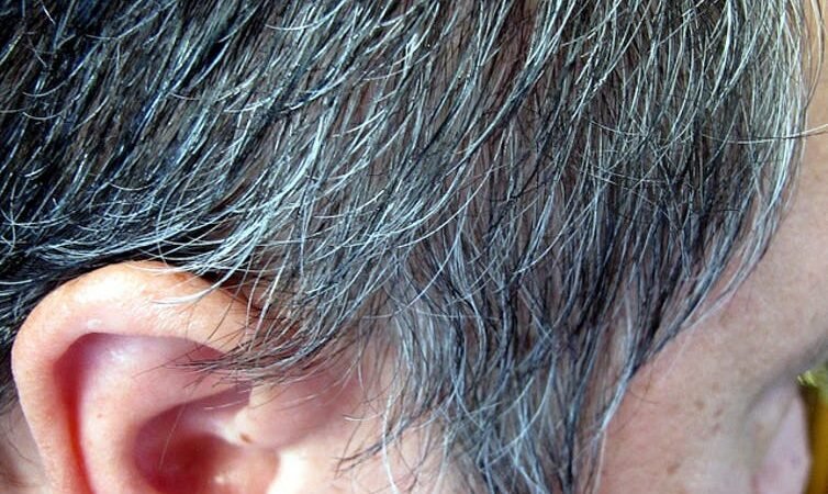 Does Sweating Lead To Hair Loss?