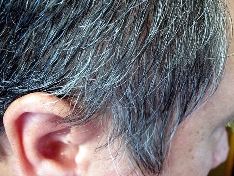 Does Sweating Lead To Hair Loss?