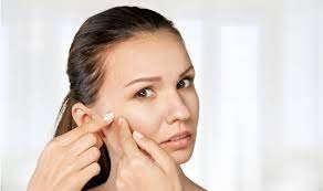 Simple tricks to get rid of pimples overnight pimples