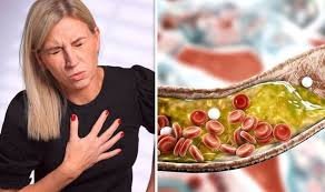 Tips to deal with your cholesterol level