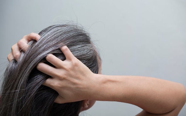 6 Best Hair Oils For Dandruff – Control The Itching and Flaking