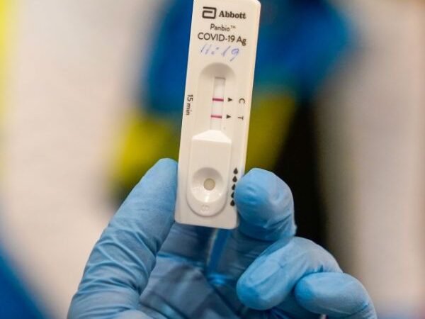 Coronavirus home testing unit and elements