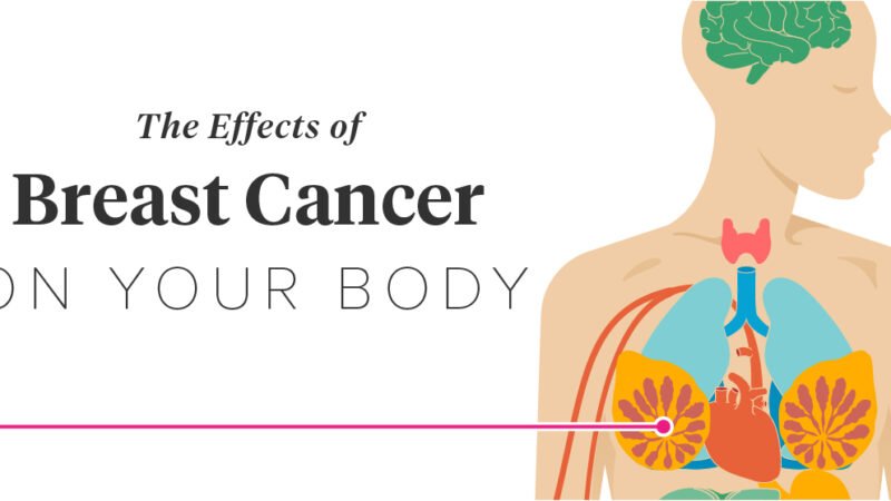 5 side effects of bosom malignant growth