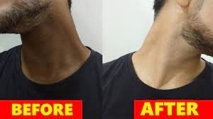 How Men Can Dispose Of Dull Neck