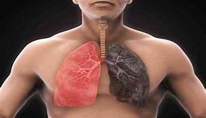 Cautioning indications of lung disease