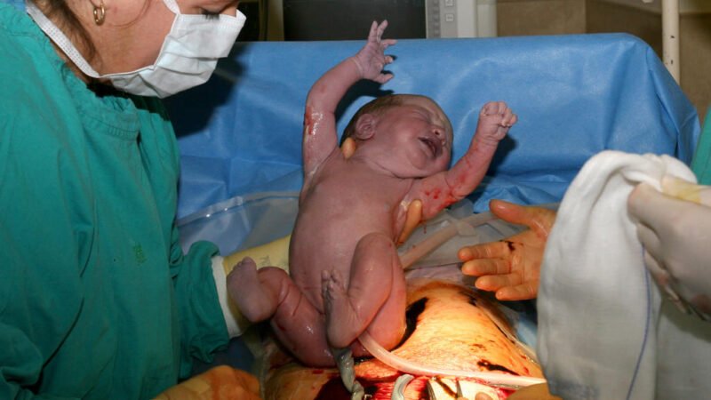 Irish review exposes claims connecting C-area