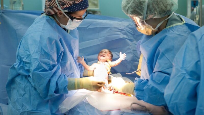 Cesarean kids stout in future