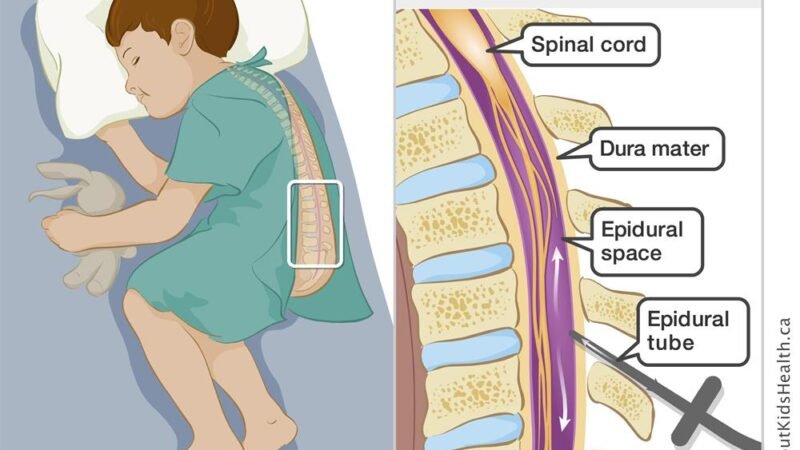 Think about taking an epidural during work