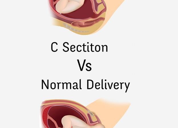 Arranged c-segment versus crisis c-area