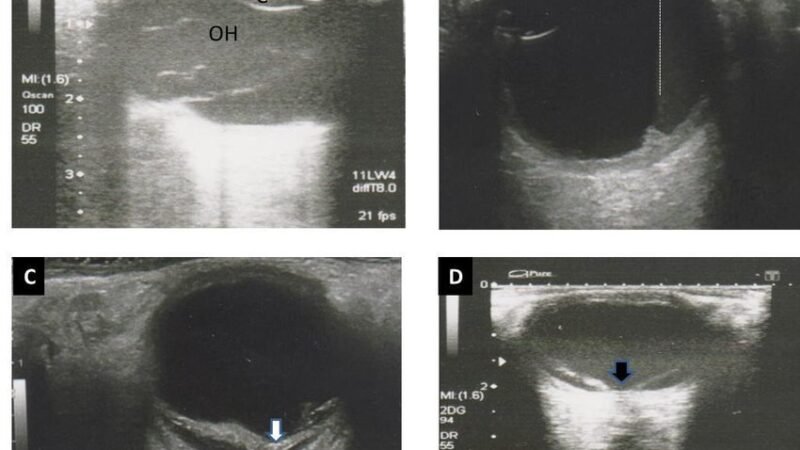 C-segment diseases can now be diminished