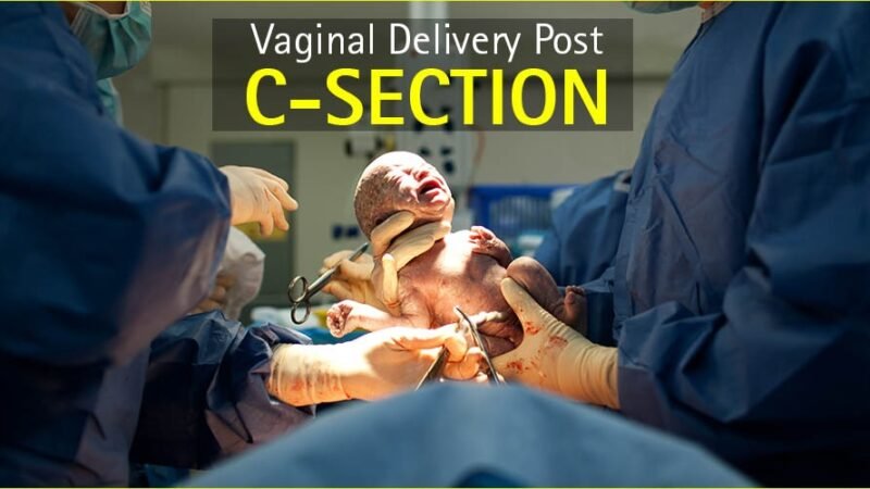 Vaginal birth after cesarean (VBAC)
