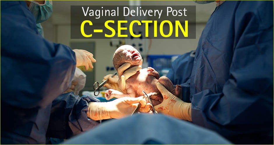 Vaginal birth after cesarean (VBAC)