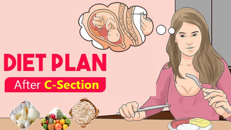 What Should Be Avoided Post-C-Section Delivery