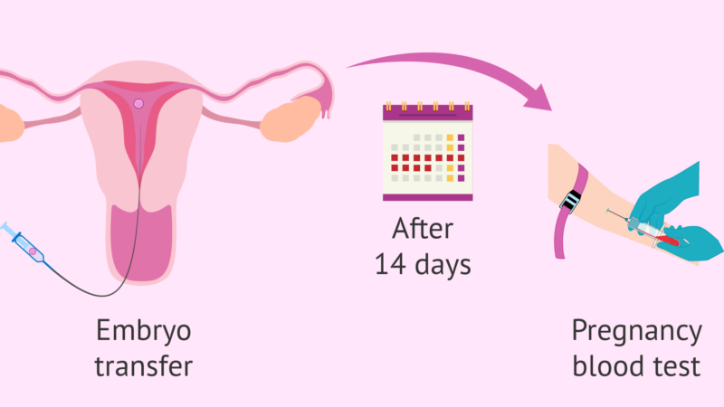 Pregnancy After IVF