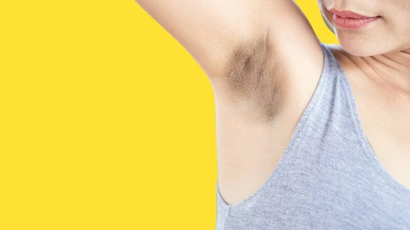 Tips To Prevent Underarm Pigmentation