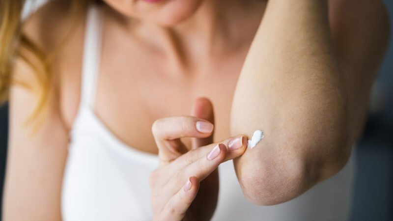 Humiliated about dull, harsh elbows?