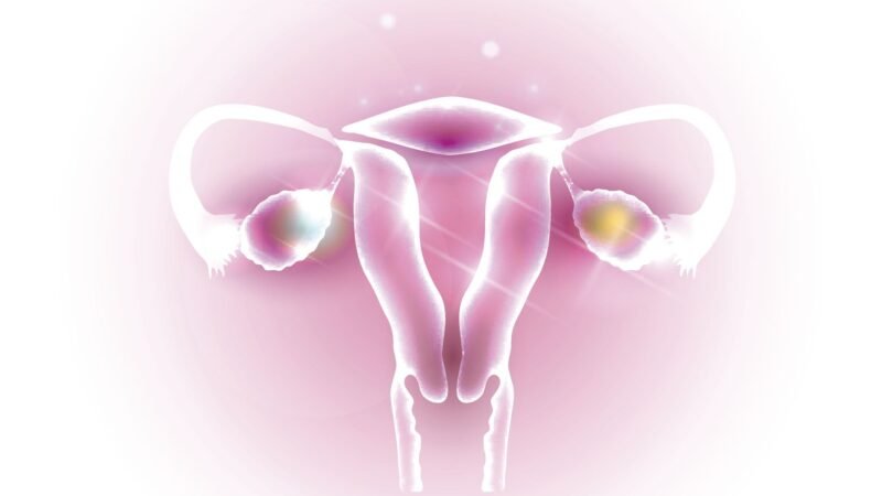 4 strange side effects of PCOS