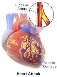 Top 5 biomarkers of a myocardial localized necrosis and other heart sicknesses