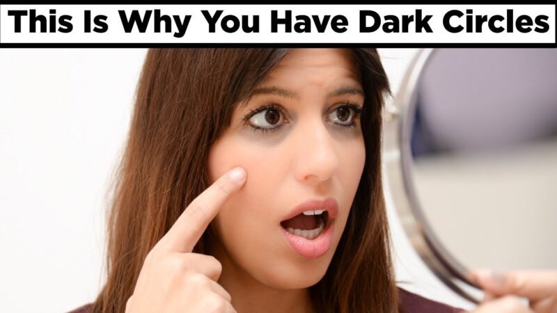 Top 5 home solutions for dispose of Dark circles