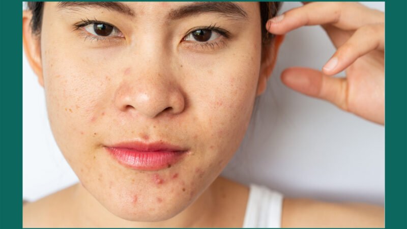 Pick your purging daily practice