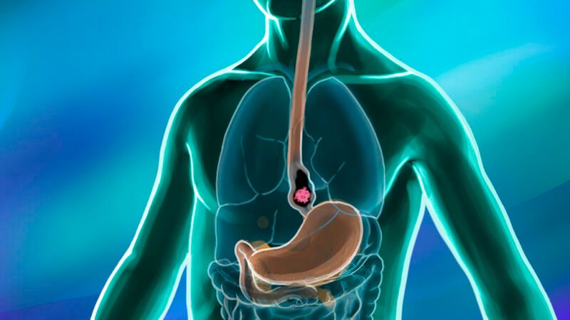 Control your oesophageal cancer with these tips