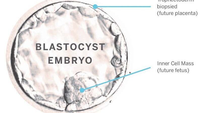 Five Tests To Identify The Cause Of It