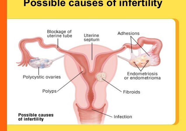 A main source of female infertility