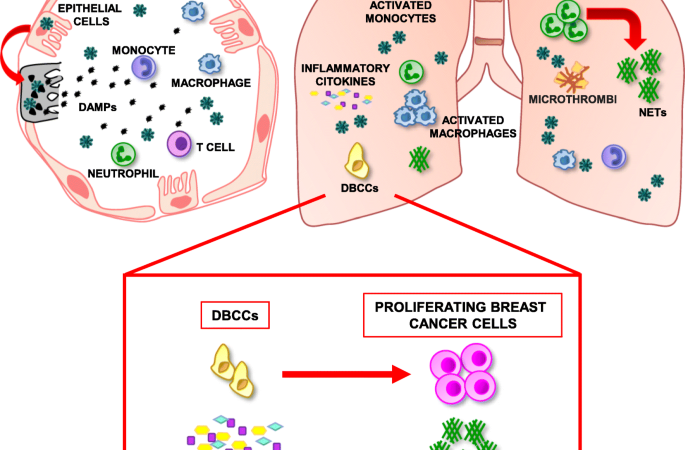 COVID-19 Leading To Rise In Breast Cancer Cases