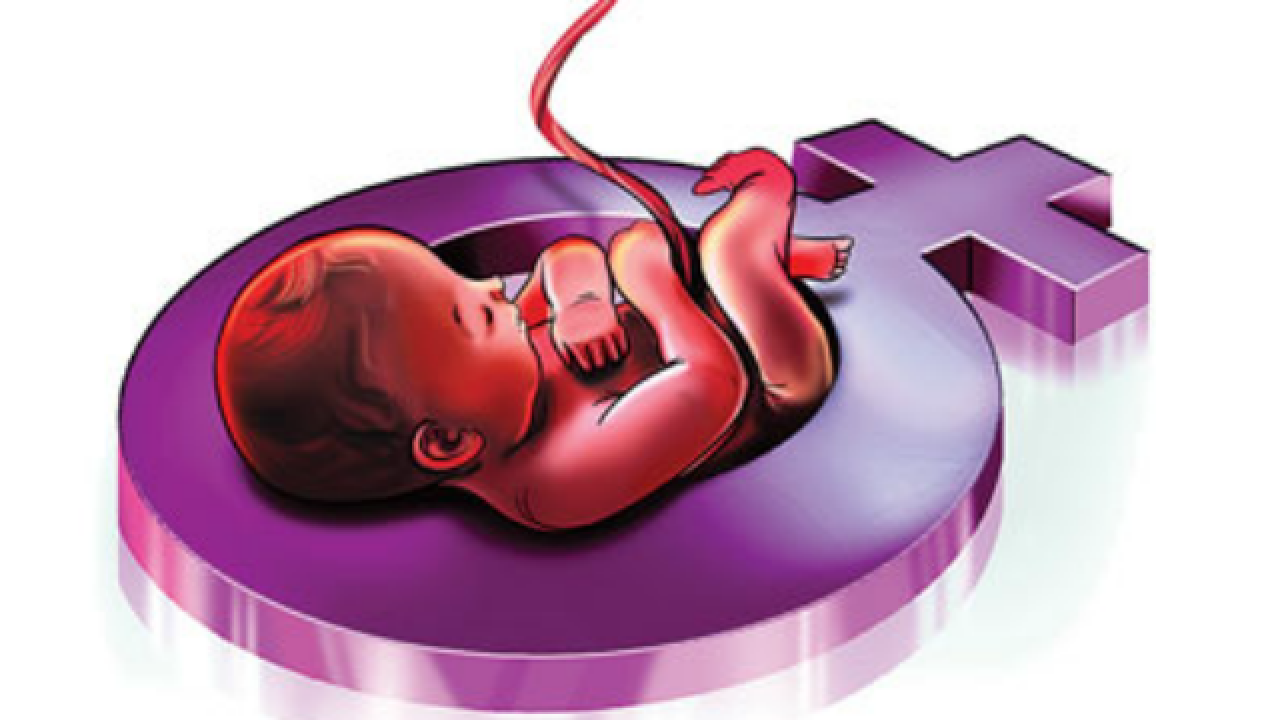 Try not to Fault doctors For Female Foeticide