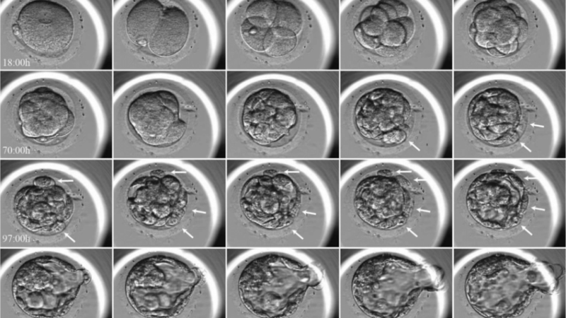 Embryoscope Can Further develop IVF