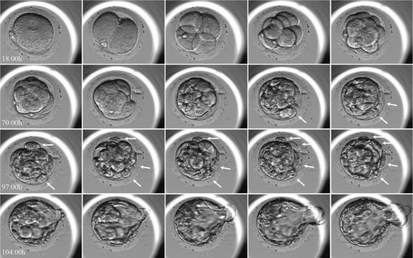 Embryoscope Can Further develop IVF