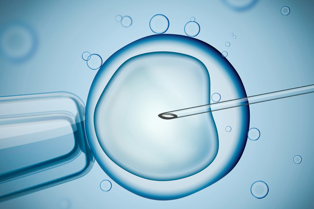 IVF: Another Expectation For The Barren