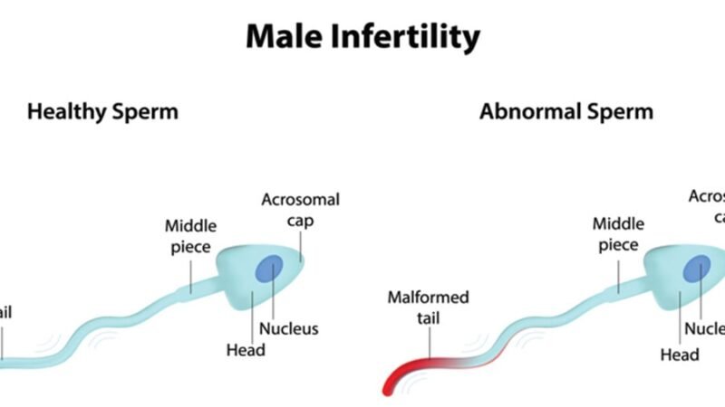 One reason Of Barrenness In Men