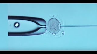 Customs During IVF Treatment