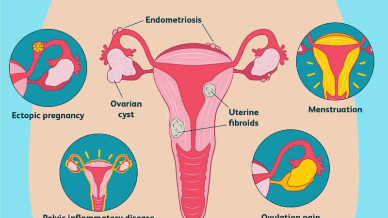 Decreased Ovarian Hold