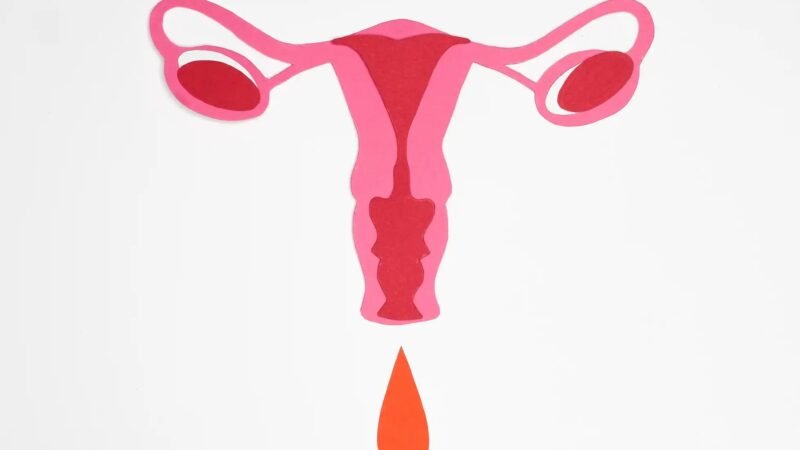 Forestall Spontaneous Pregnancies